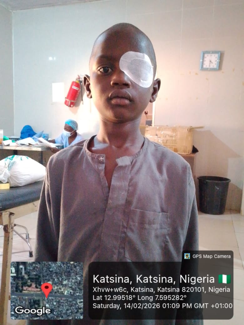 A young patient after successful eye surgery in Katsina